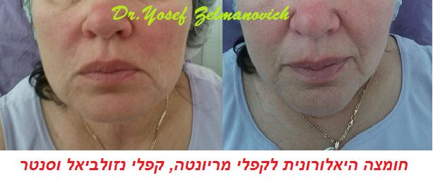 Др. Иосиф Зельманович - эстетическая медицина