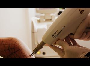 Maestro Laser clinic
