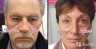 Без ботокса и операций молодеем на 10 лет за 2 минуты !! Ageless - ко Дню Влюбленных!